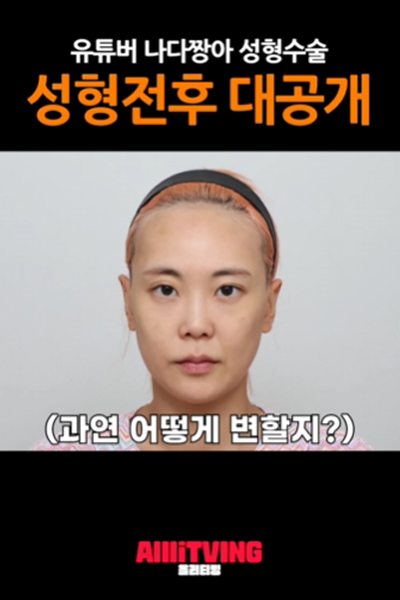 유튜버 나다짱아 성형수술 성형전후 대공개