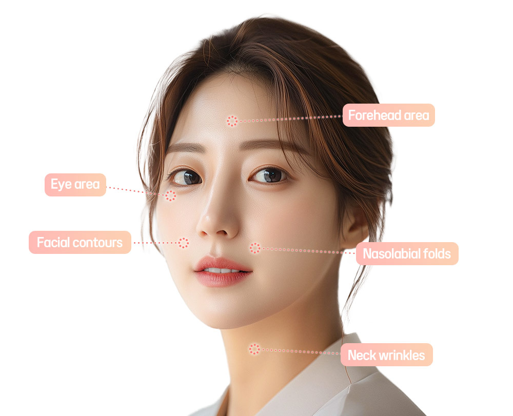 Areas that can be treated with Mint Thread Lifting